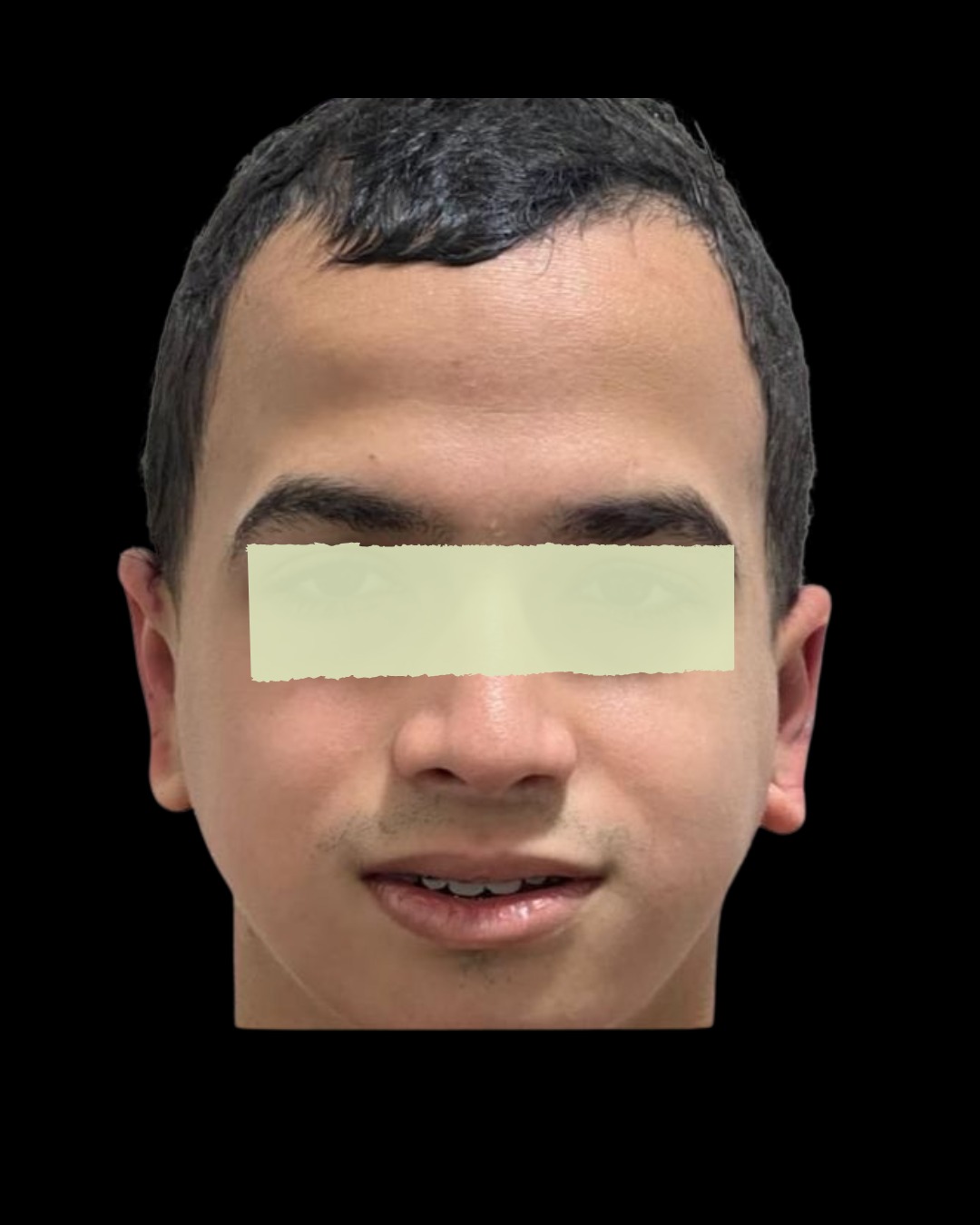 Depois